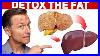 A Unique Way To Clean A Fatty Toxic Liver That You Ve Never Heard About